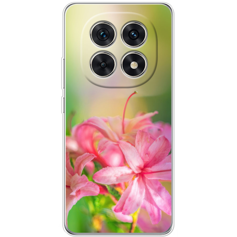 Чохол BoxFace Xiaomi Redmi Note 15 5G 