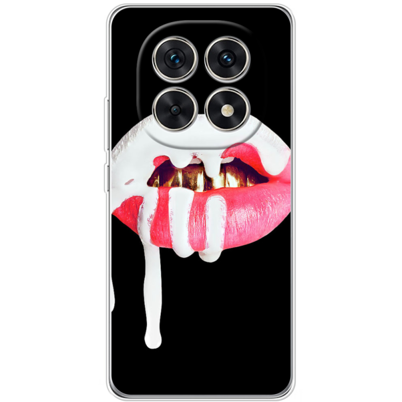 Чохол BoxFace Xiaomi Redmi Note 15 5G 