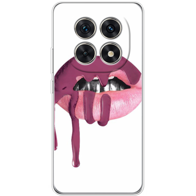 Чохол BoxFace Xiaomi Redmi Note 15 5G 