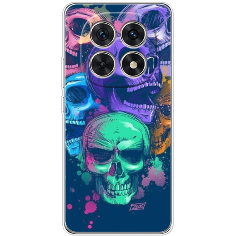 Чохол BoxFace Xiaomi Redmi Note 15 5G 