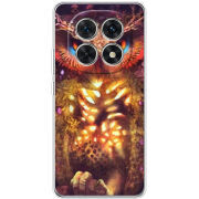 Чохол BoxFace Xiaomi Redmi Note 15 5G 