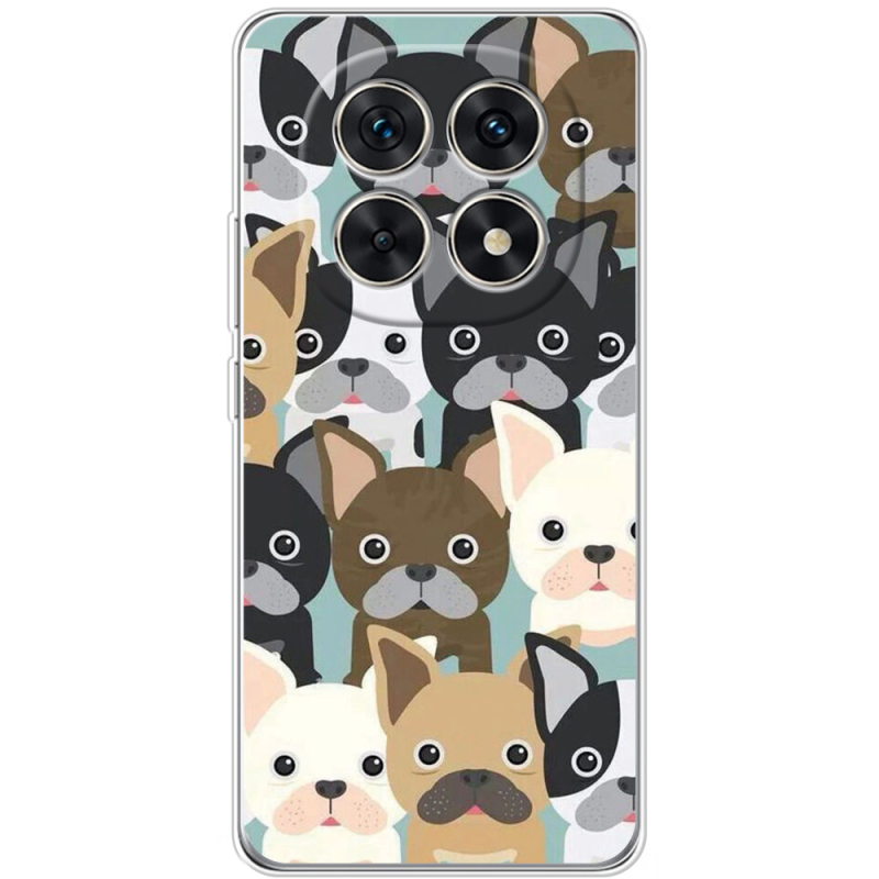 Чохол BoxFace Xiaomi Redmi Note 15 5G 