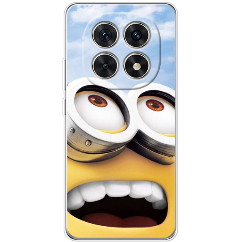 Чохол BoxFace Xiaomi Redmi Note 15 5G 