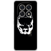 Чохол BoxFace Xiaomi Redmi Note 15 5G 