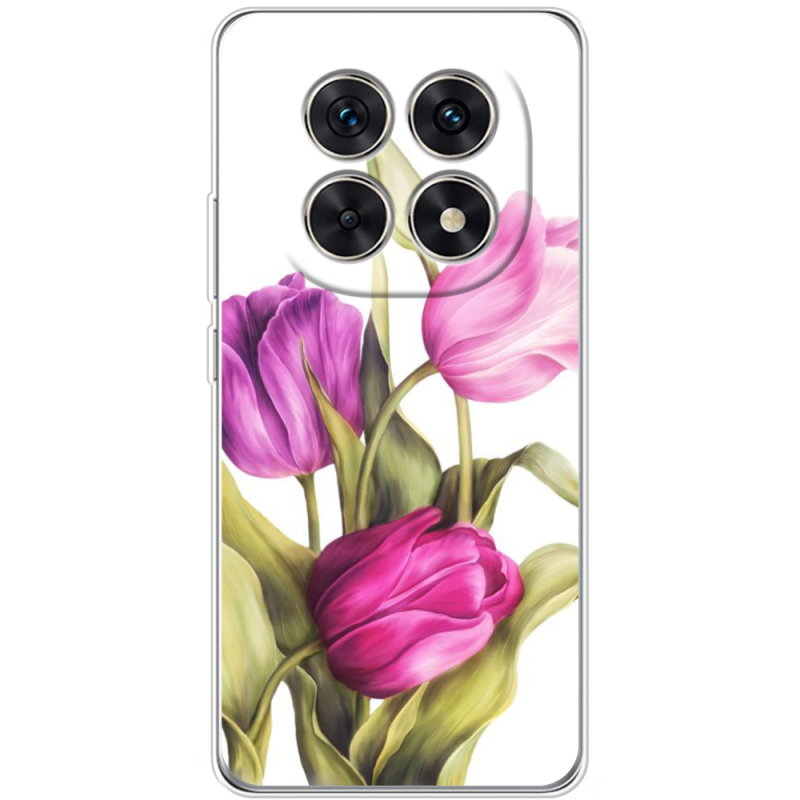 Чохол BoxFace Xiaomi Redmi Note 15 5G 