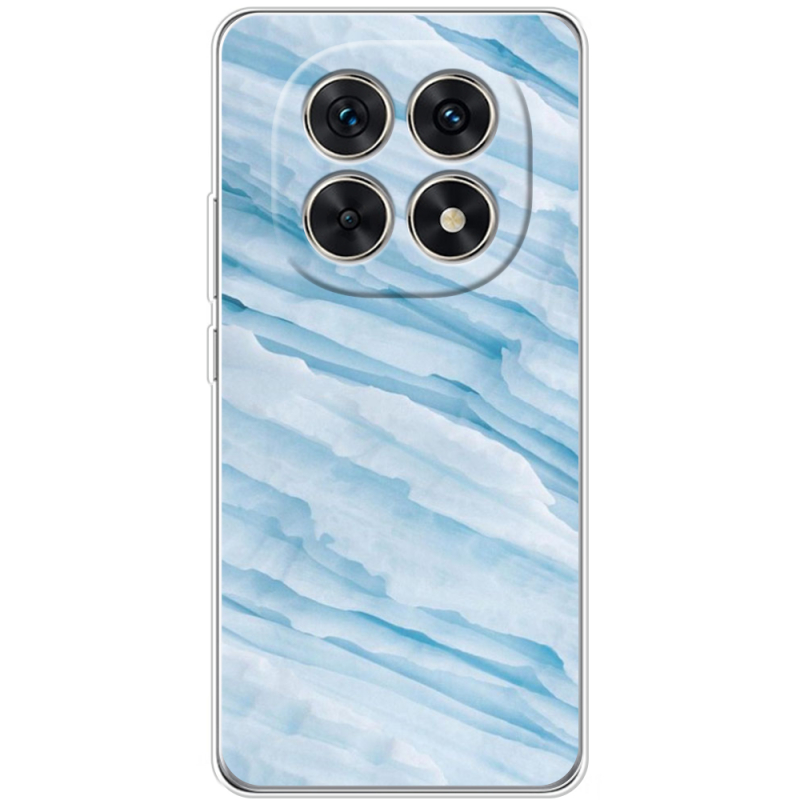 Чохол BoxFace Xiaomi Redmi Note 15 5G 