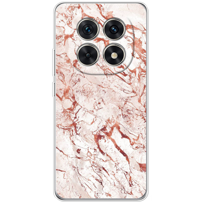 Чохол BoxFace Xiaomi Redmi Note 15 5G 