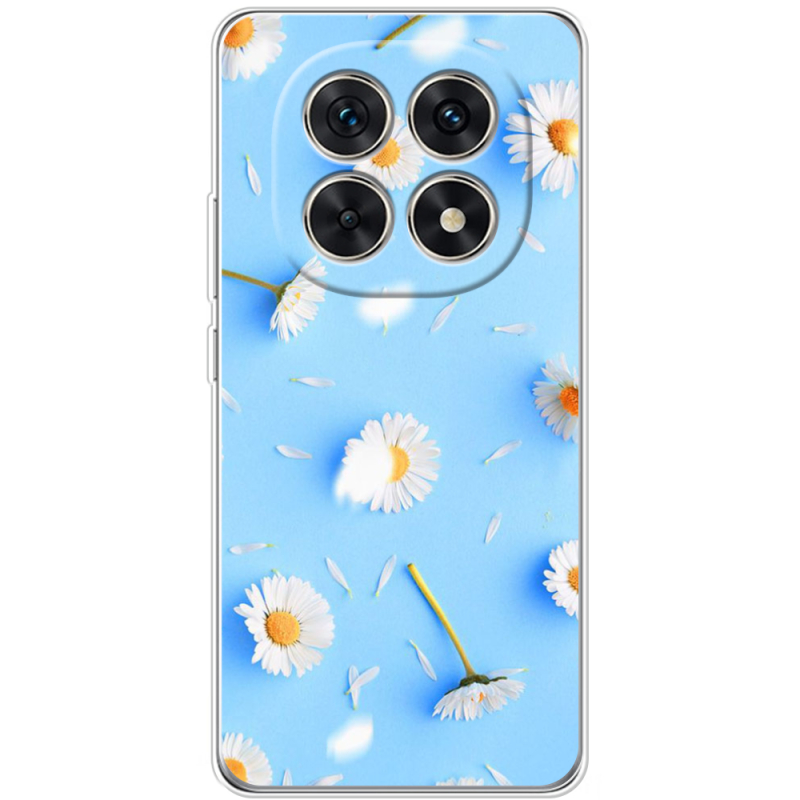 Чохол BoxFace Xiaomi Redmi Note 15 5G 