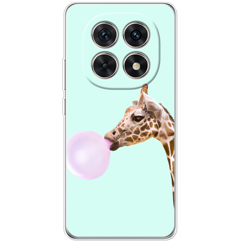 Чохол BoxFace Xiaomi Redmi Note 15 5G 