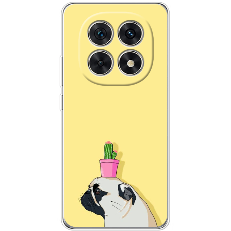 Чохол BoxFace Xiaomi Redmi Note 15 5G 