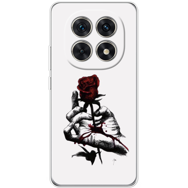 Чохол BoxFace Xiaomi Redmi Note 15 5G 