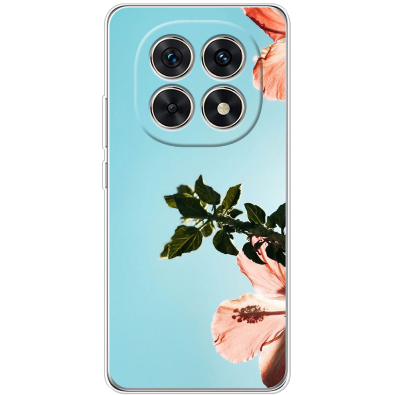 Чохол BoxFace Xiaomi Redmi Note 15 5G 