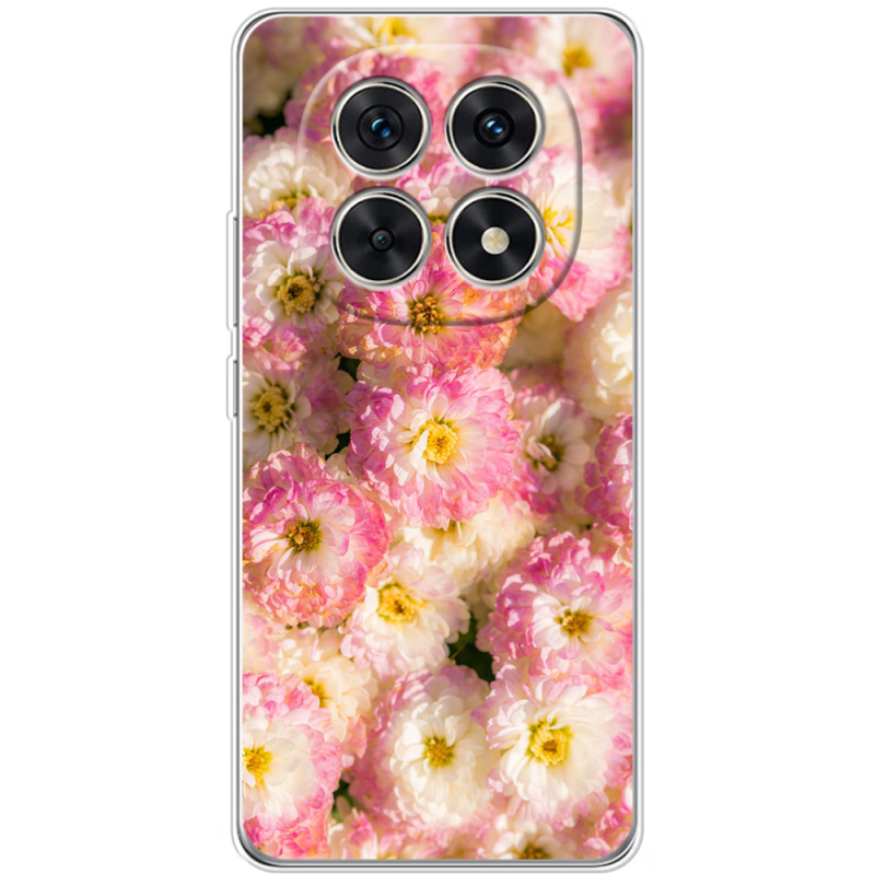 Чохол BoxFace Xiaomi Redmi Note 15 5G 