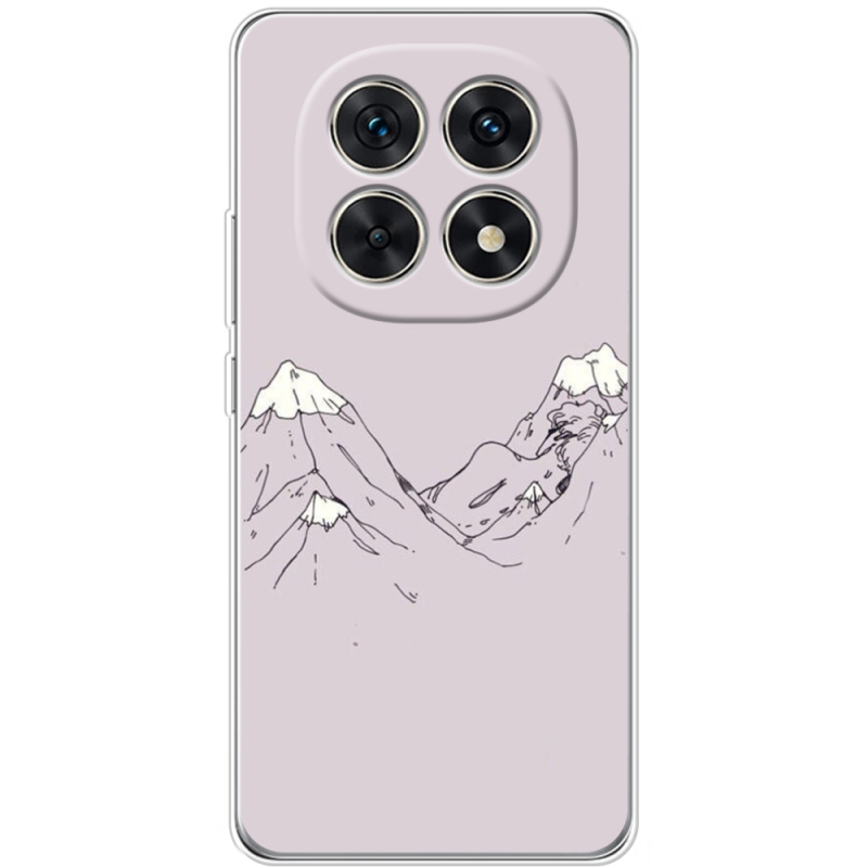 Чохол BoxFace Xiaomi Redmi Note 15 5G 