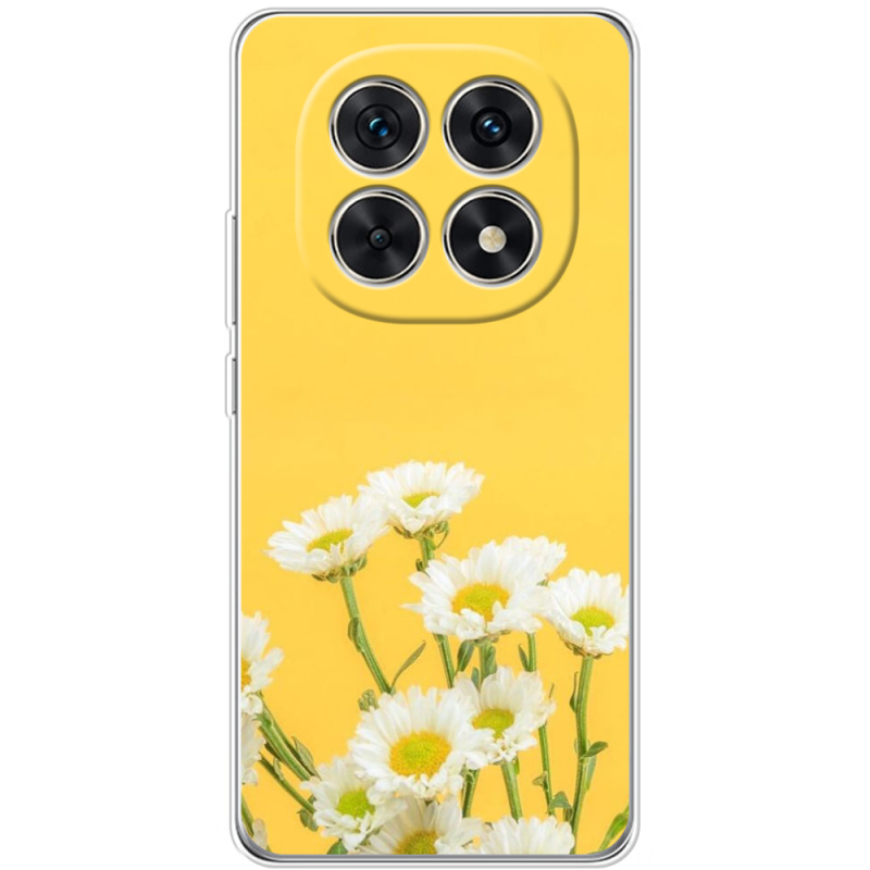 Чохол BoxFace Xiaomi Redmi Note 15 5G 