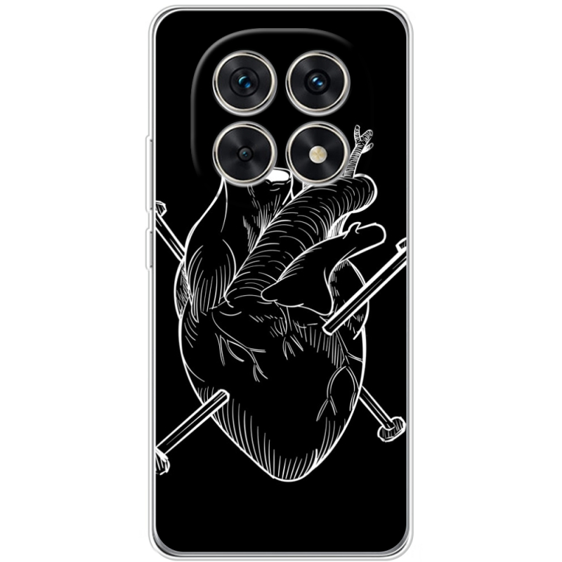 Чохол BoxFace Xiaomi Redmi Note 15 5G 