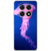 Чохол BoxFace Xiaomi Redmi Note 15 5G 