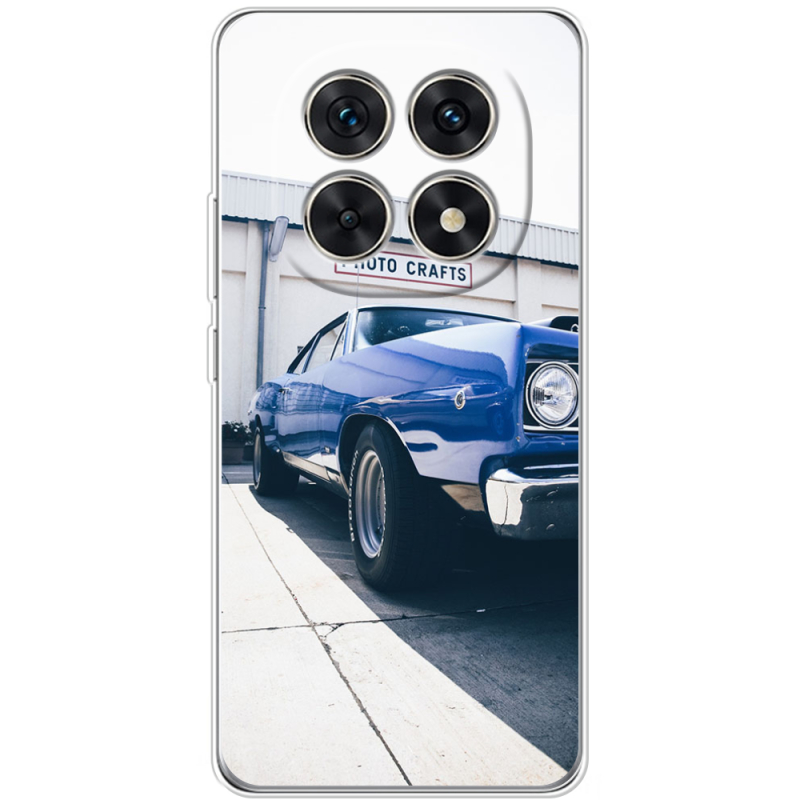 Чохол BoxFace Xiaomi Redmi Note 15 5G 