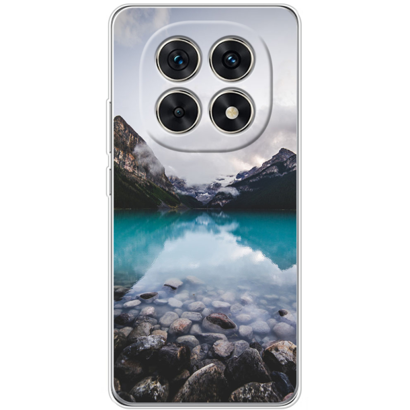 Чохол BoxFace Xiaomi Redmi Note 15 5G 