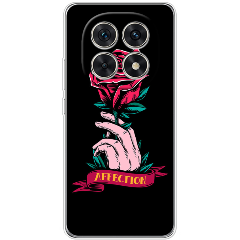 Чохол BoxFace Xiaomi Redmi Note 15 5G 