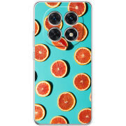 Чохол BoxFace Xiaomi Redmi Note 15 5G 