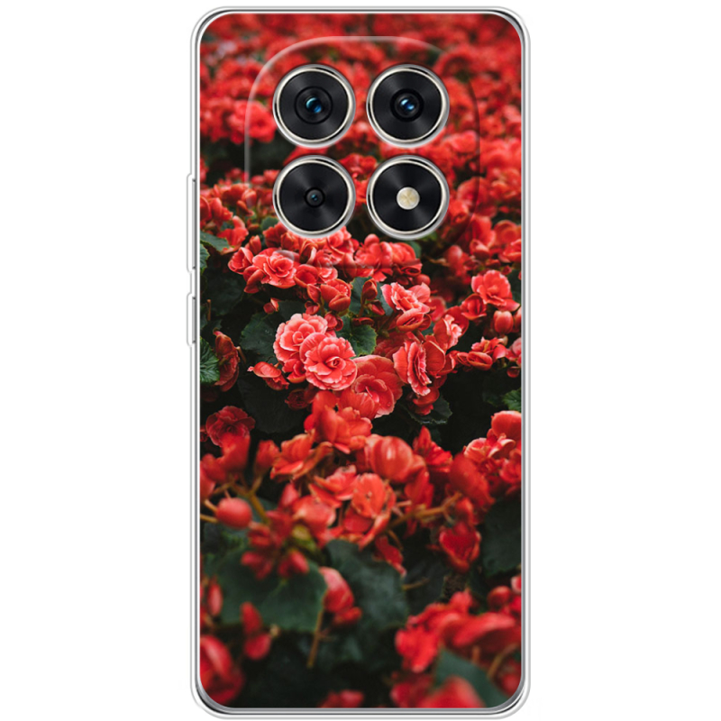 Чохол BoxFace Xiaomi Redmi Note 15 5G 