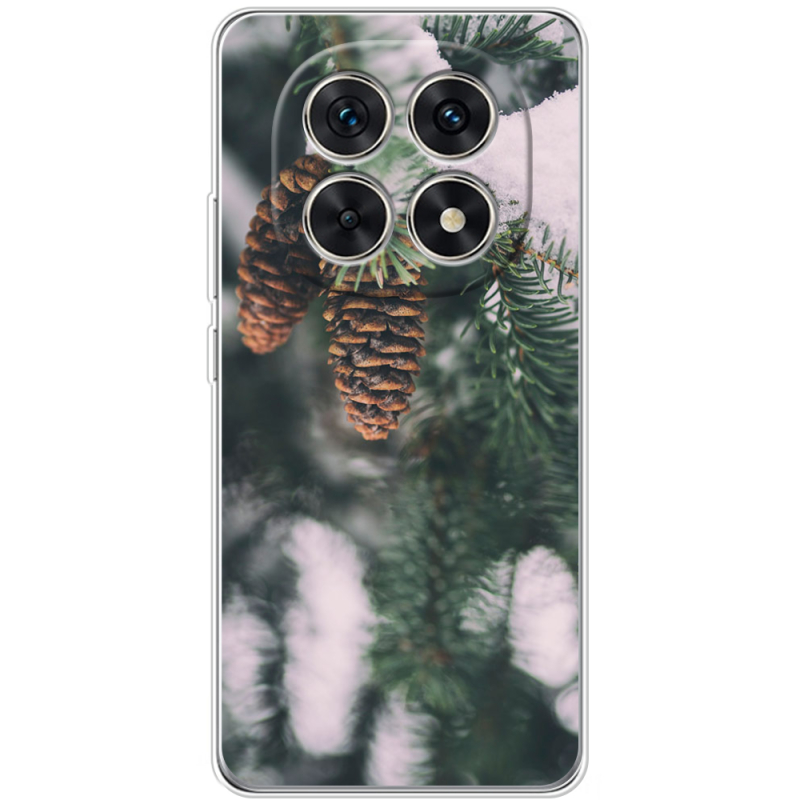 Чохол BoxFace Xiaomi Redmi Note 15 5G 