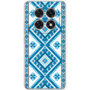 Чохол BoxFace Xiaomi Redmi Note 15 5G Блакитний Орнамент
