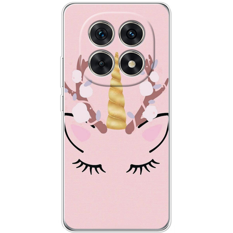 Чохол BoxFace Xiaomi Redmi Note 15 5G 