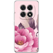 Чохол BoxFace Xiaomi Redmi Note 15 5G 