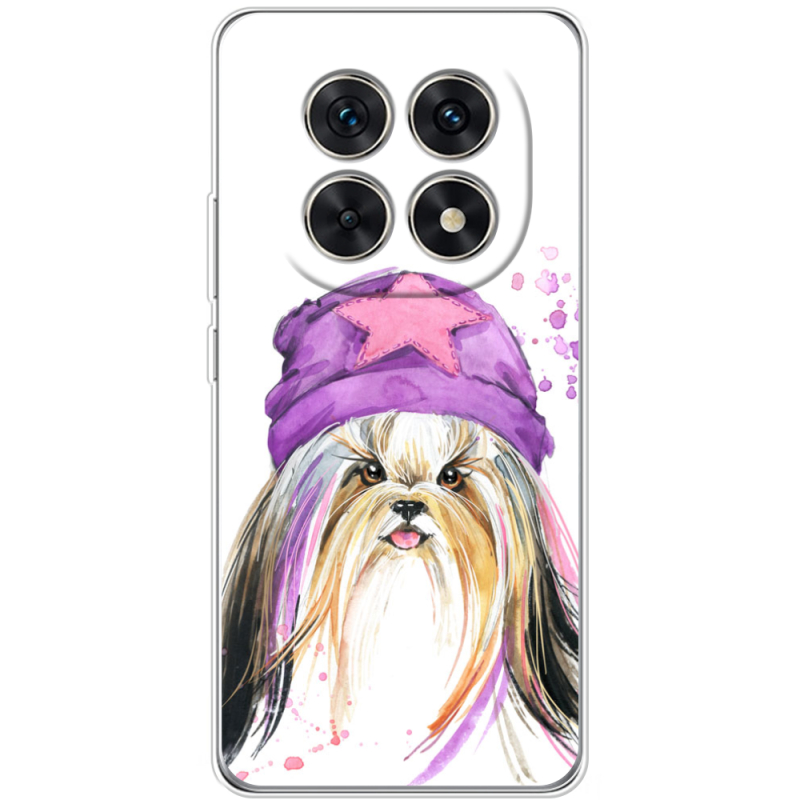 Чохол BoxFace Xiaomi Redmi Note 15 5G 