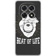 Чохол BoxFace Xiaomi Redmi Note 15 5G 