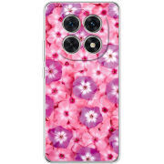 Чохол BoxFace Xiaomi Redmi Note 15 5G 