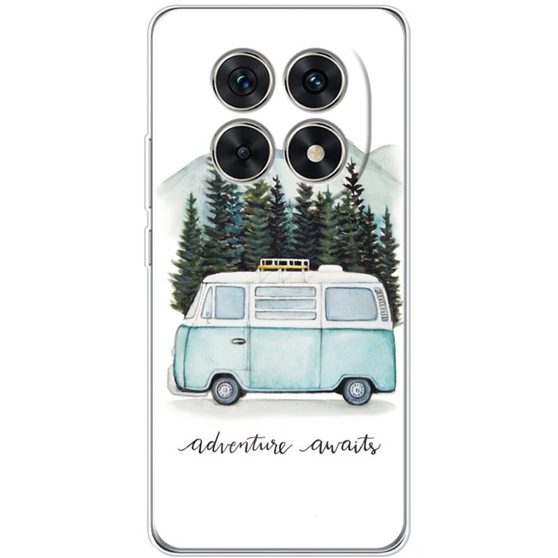 Чохол BoxFace Xiaomi Redmi Note 15 5G 