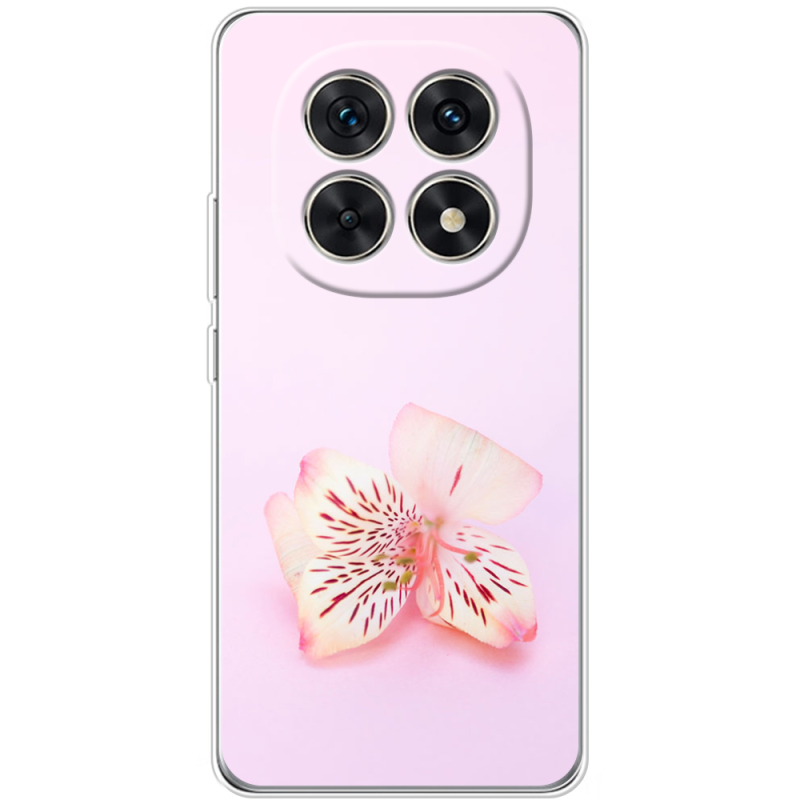 Чохол BoxFace Xiaomi Redmi Note 15 5G 