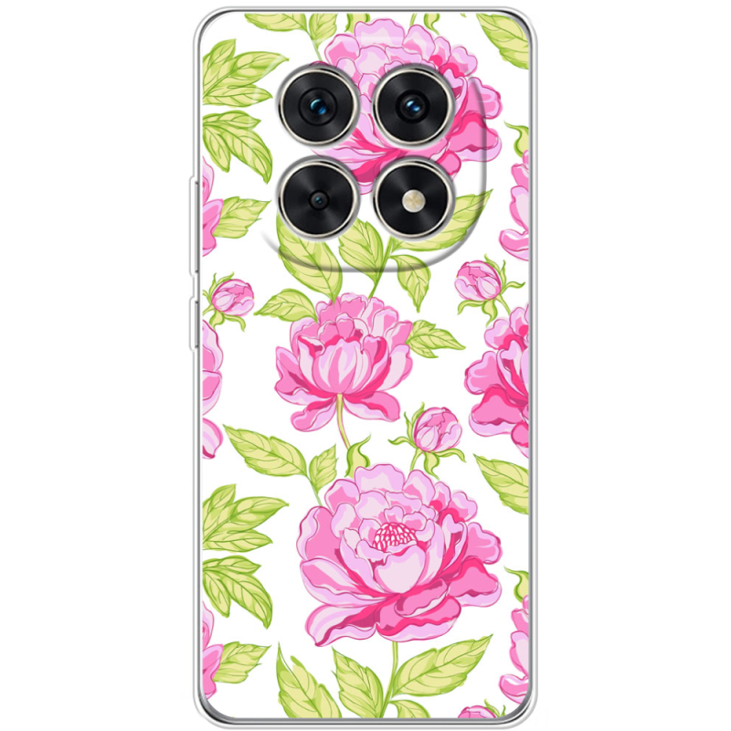 Чохол BoxFace Xiaomi Redmi Note 15 5G 