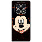 Чохол BoxFace Xiaomi Redmi Note 15 5G 