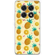 Чохол BoxFace Xiaomi Redmi Note 15 5G 