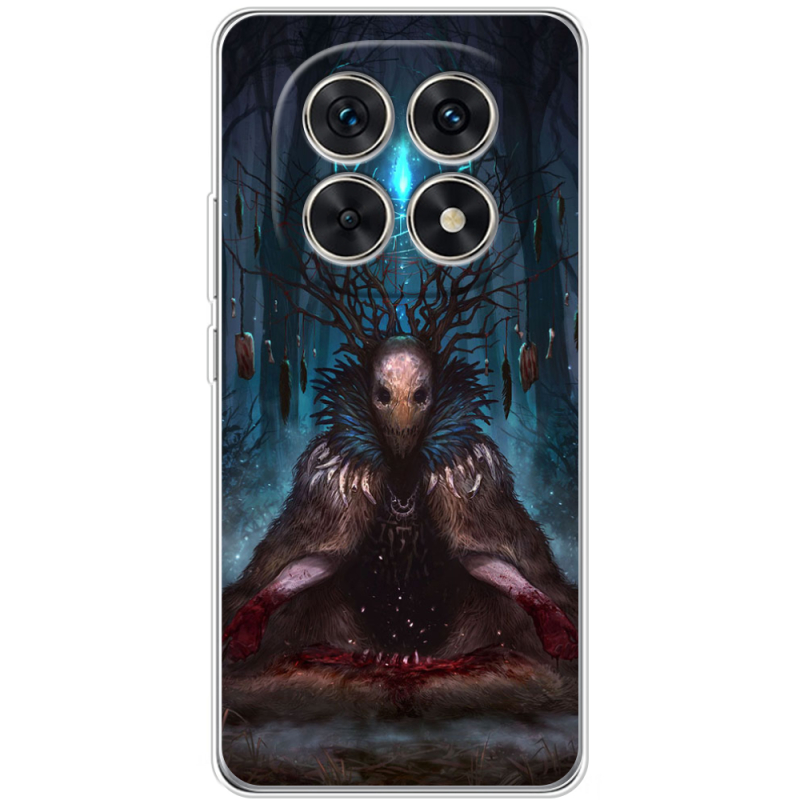 Чохол BoxFace Xiaomi Redmi Note 15 5G 