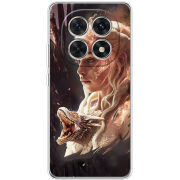 Чохол BoxFace Xiaomi Redmi Note 15 5G 