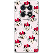 Чохол BoxFace Xiaomi Redmi Note 15 5G 