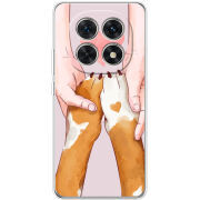 Чохол BoxFace Xiaomi Redmi Note 15 5G 