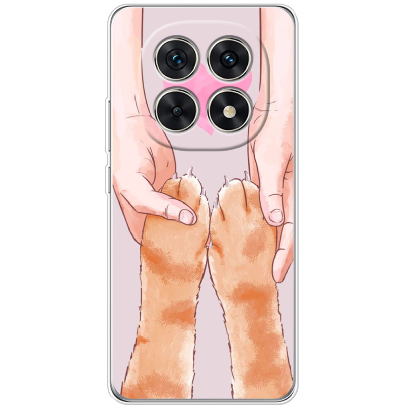 Чохол BoxFace Xiaomi Redmi Note 15 5G 