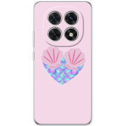 Чохол BoxFace Xiaomi Redmi Note 15 5G 