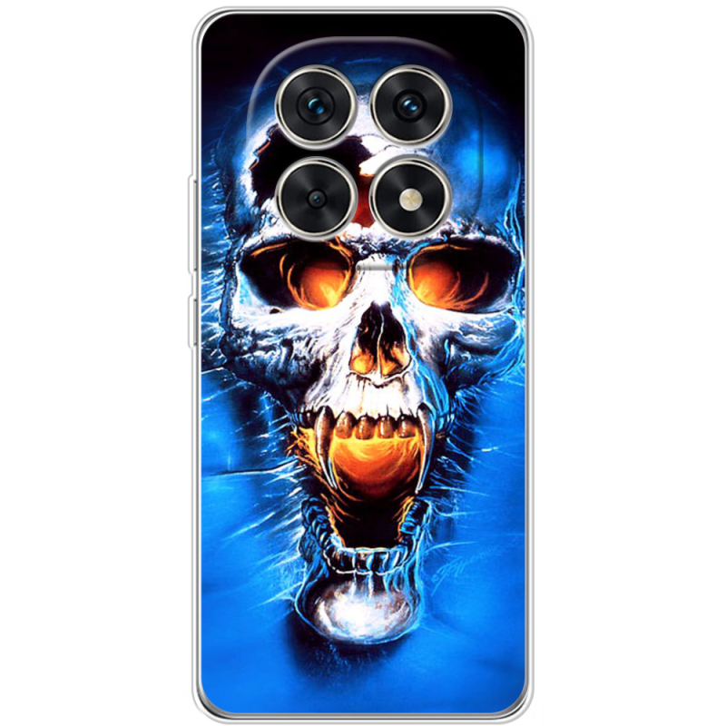 Чохол BoxFace Xiaomi Redmi Note 15 5G 