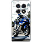 Чохол BoxFace Xiaomi Redmi Note 15 5G 