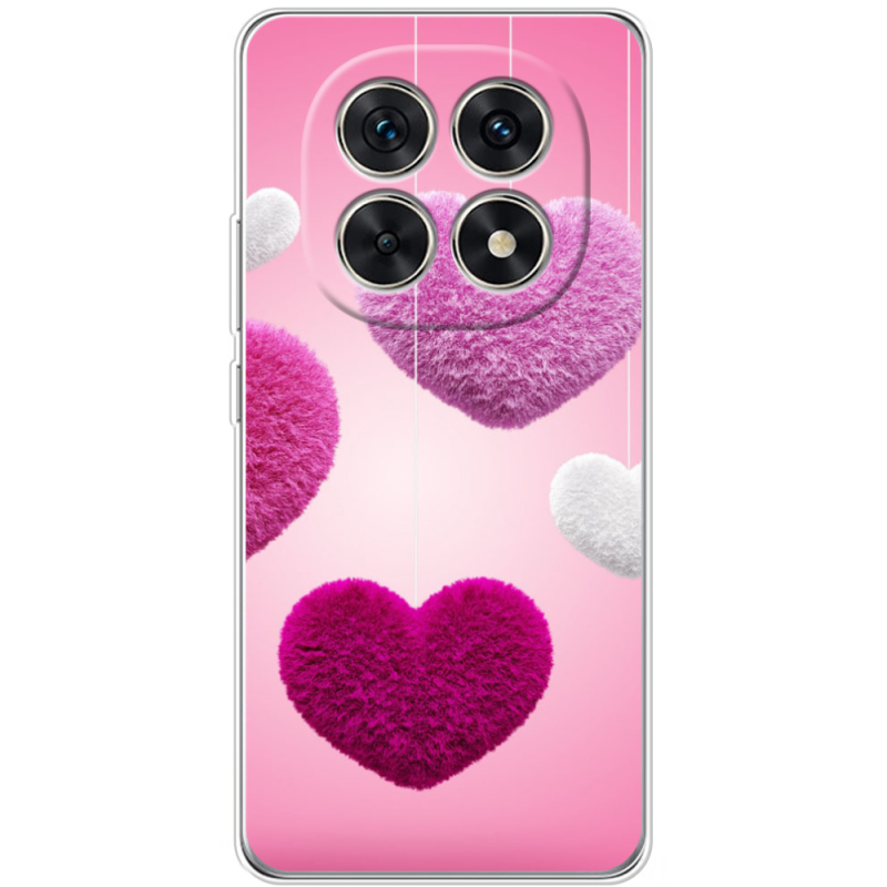 Чохол BoxFace Xiaomi Redmi Note 15 5G 