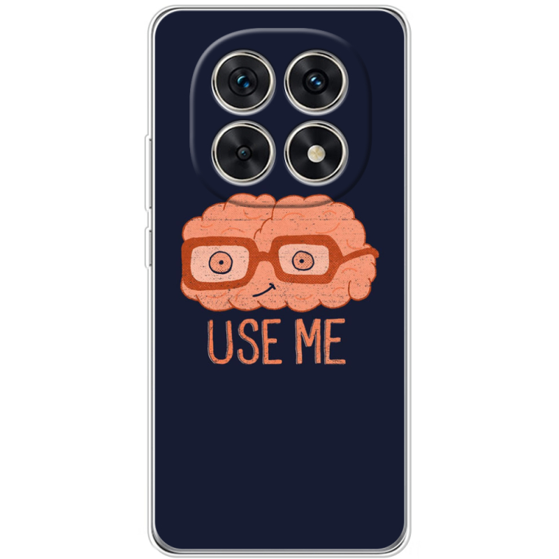 Чохол BoxFace Xiaomi Redmi Note 15 5G 