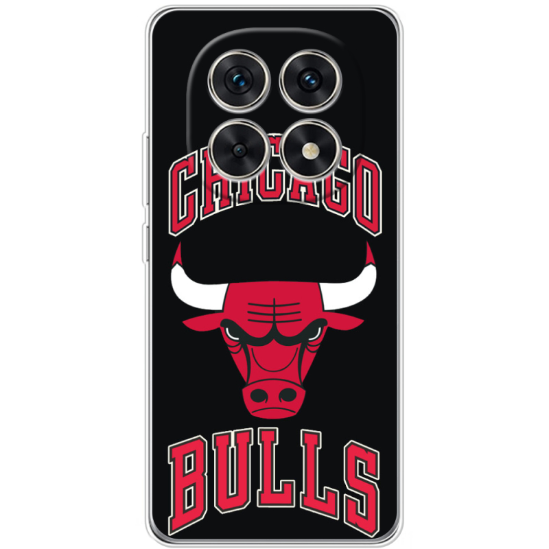 Чохол BoxFace Xiaomi Redmi Note 15 5G 