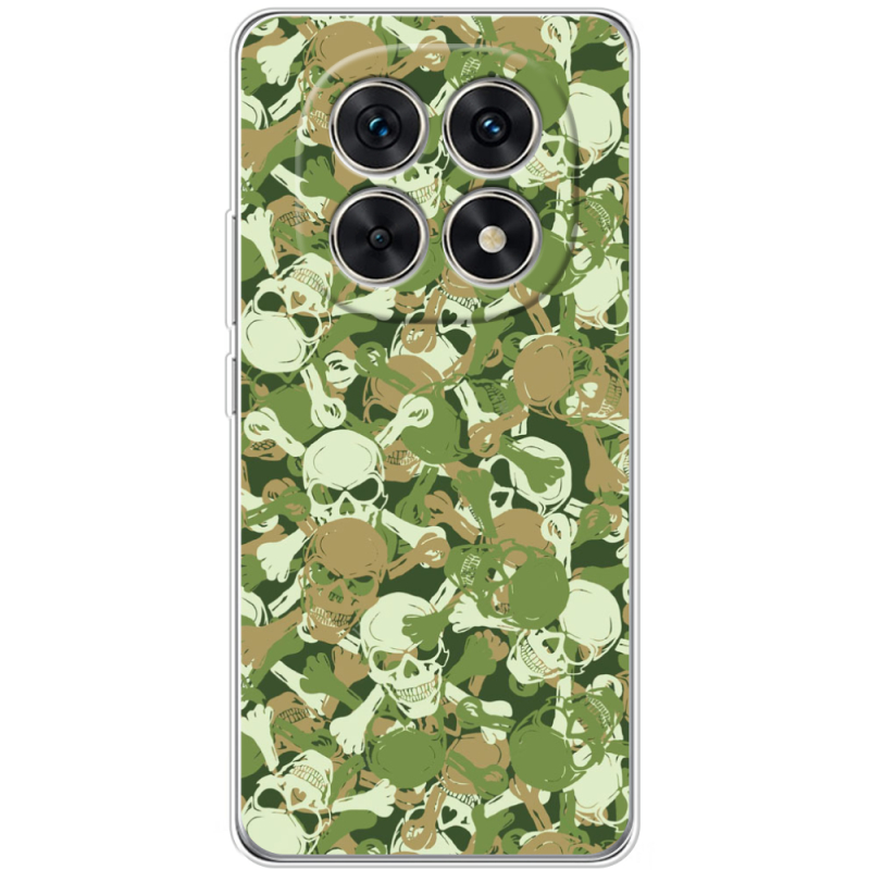 Чохол BoxFace Xiaomi Redmi Note 15 5G 